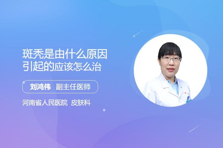 斑秃是由什么原因引起的应该怎么治