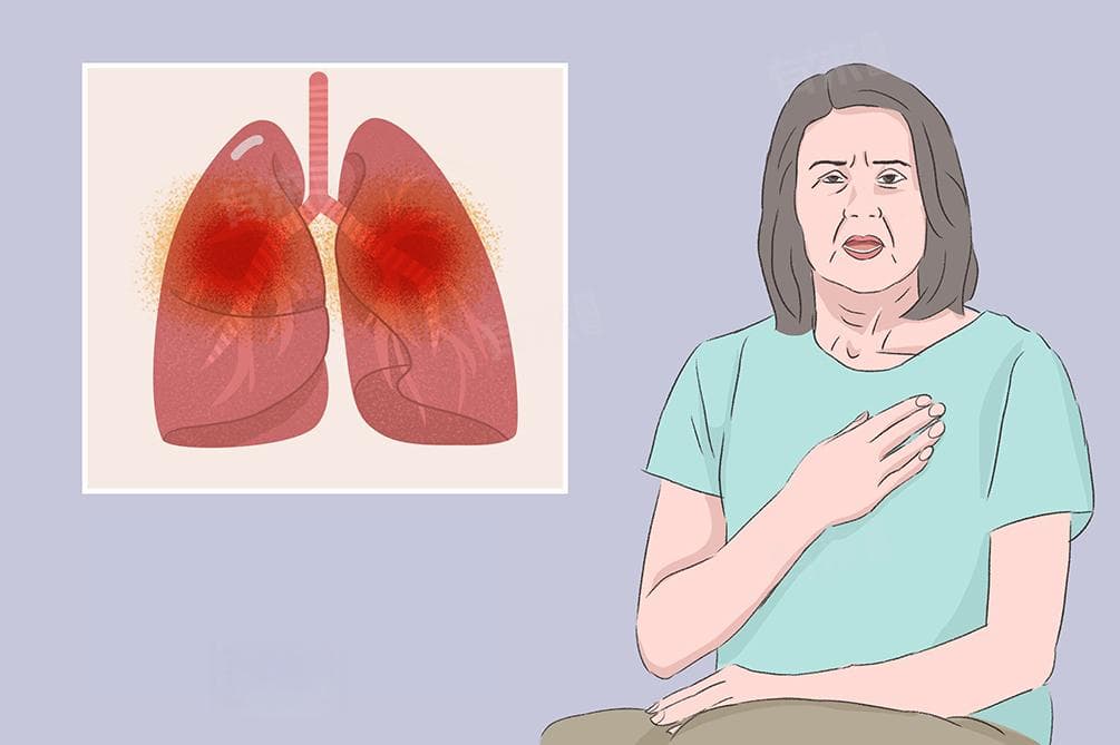 肺炎是做胸片还是CT