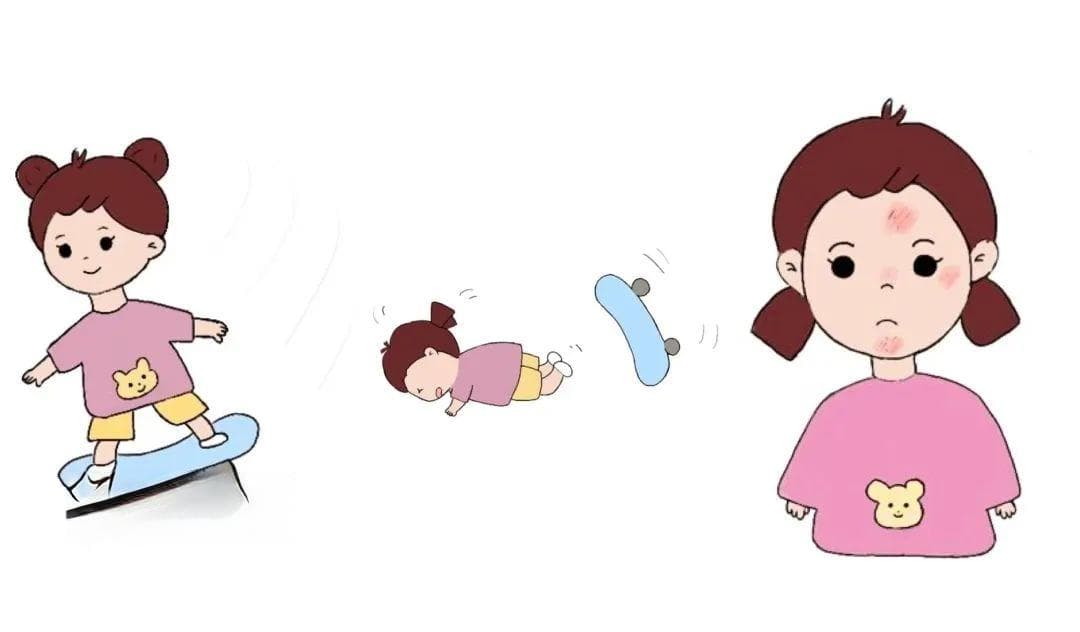 别慌！孩子突发头面部外伤可以这样处理