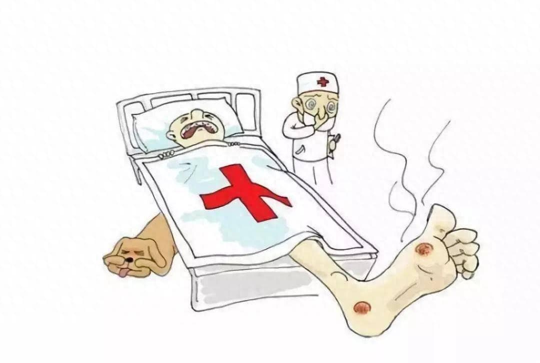 糖尿病患者足部出现这些症状，快去就医！小心糖尿病足！