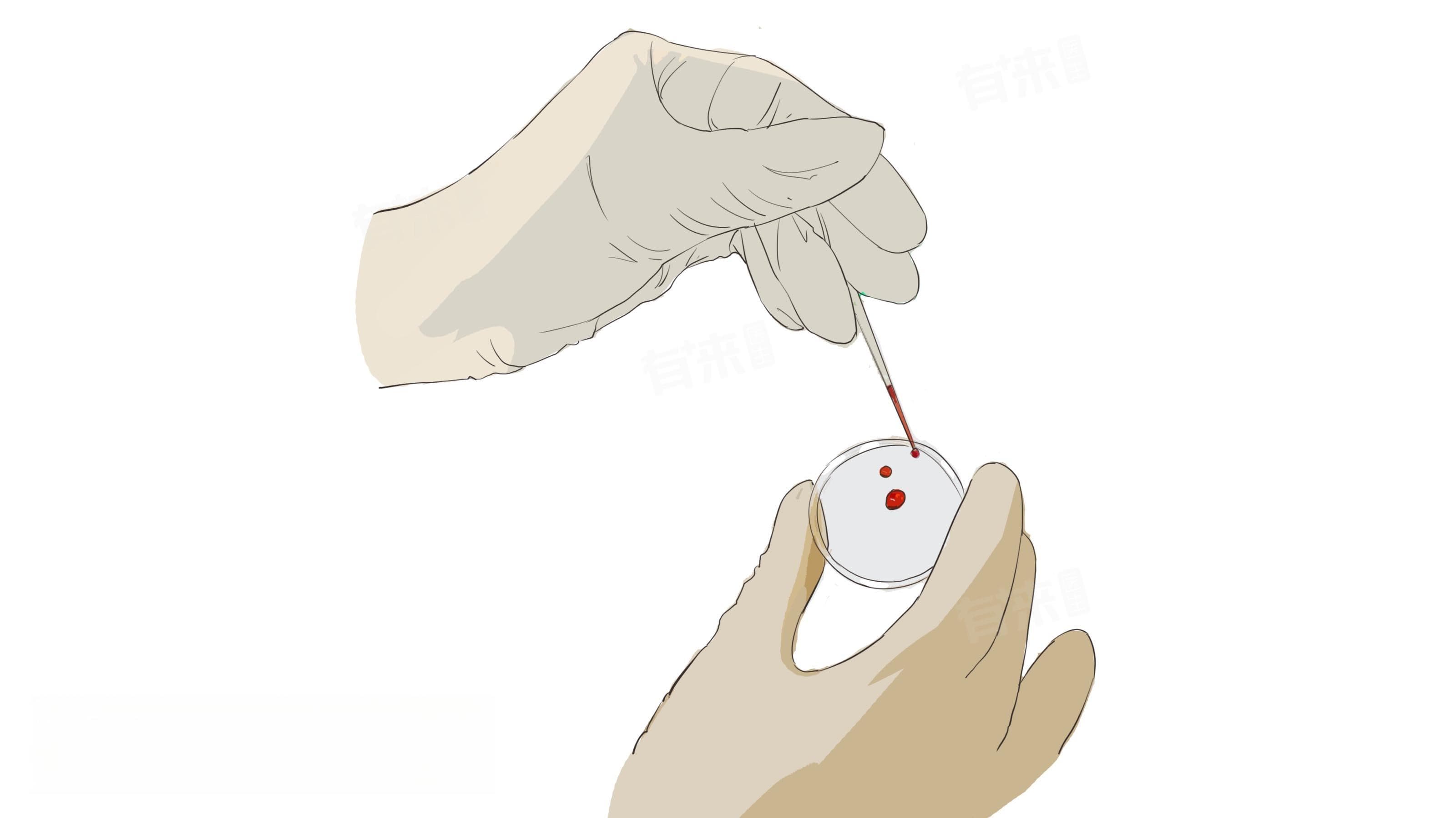 Rh(D)阳性是什么意思？详解Rh血型系统及其临床意义