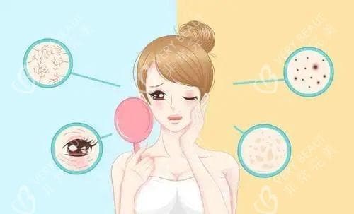 调Q激光治疗色斑需要几次才能去除？治疗后会反弹吗？