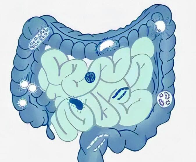 肠道菌群与癌症之间的潜在联系