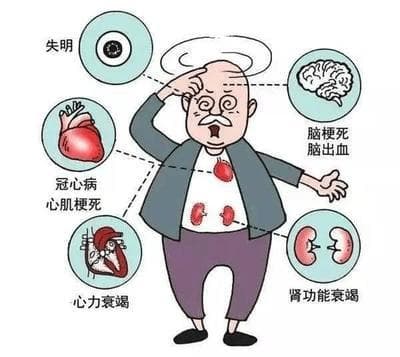 【健康科普】老年高血压患者需要关注的常见问题