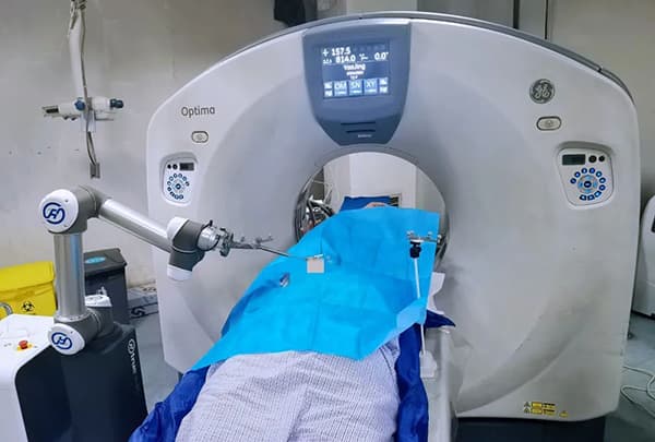 AI赋能医疗：机器人助力肺穿刺手术实现精准化