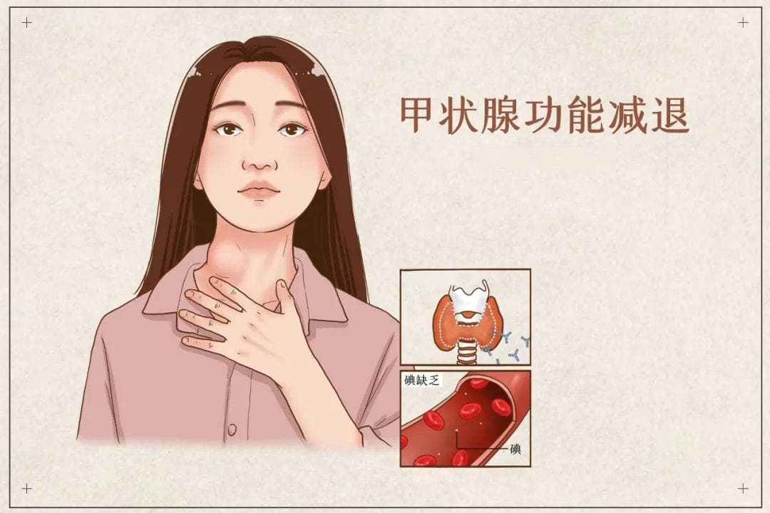 查出骨质疏松，先别急着治，全身都查一遍，可能是这些原因