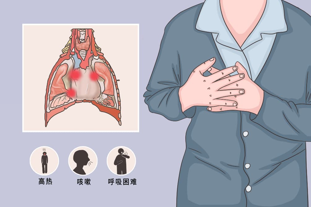 纵隔感染：病因、症状、诊断与治疗全解析