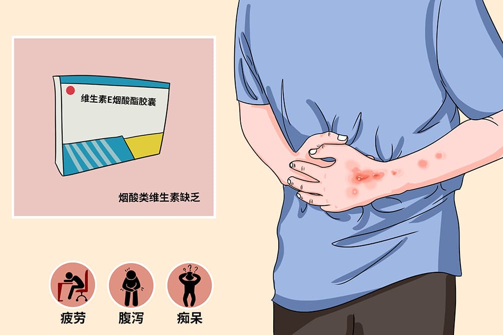 烟酸是什么东西