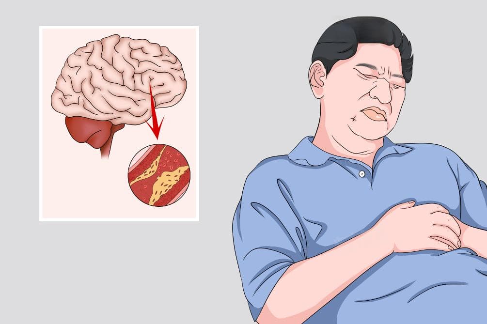 阿斯综合症的表现