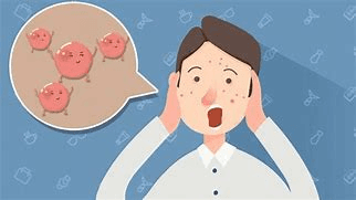 男性也要护肤！常见皮肤病及护理指南
