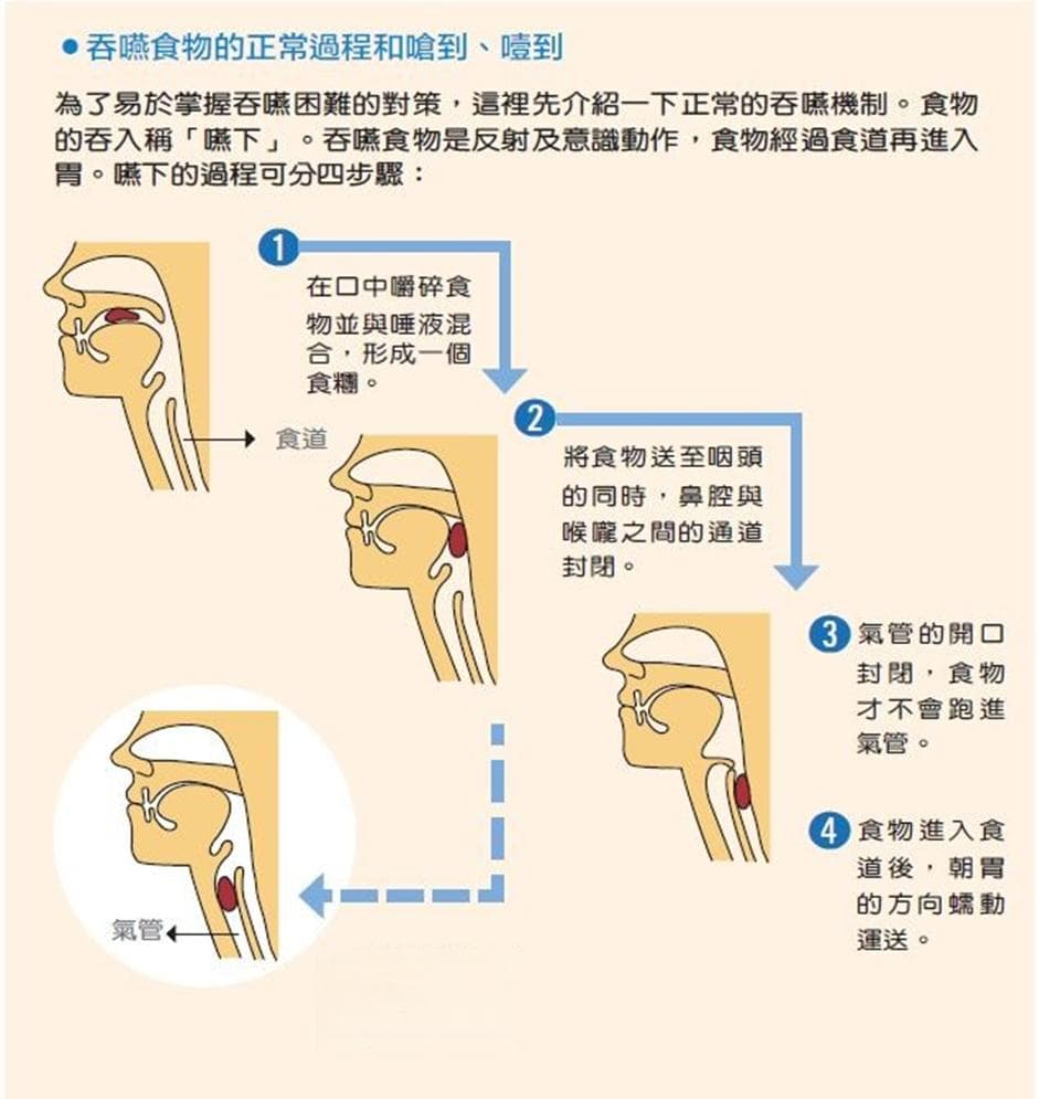 ALS患者吞咽困难时的日常照顾与训练指南