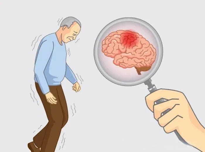 热传的手术治疗阿尔茨海默病可行吗？