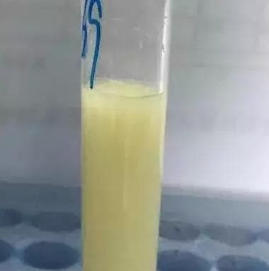 腹水听得多了，胸水又是什么？