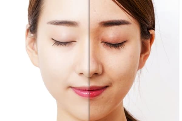 什么是满月脸？库欣面容的成因、诊断与治疗全解析