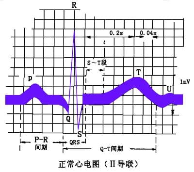 心电图（ECG）基础知识详解