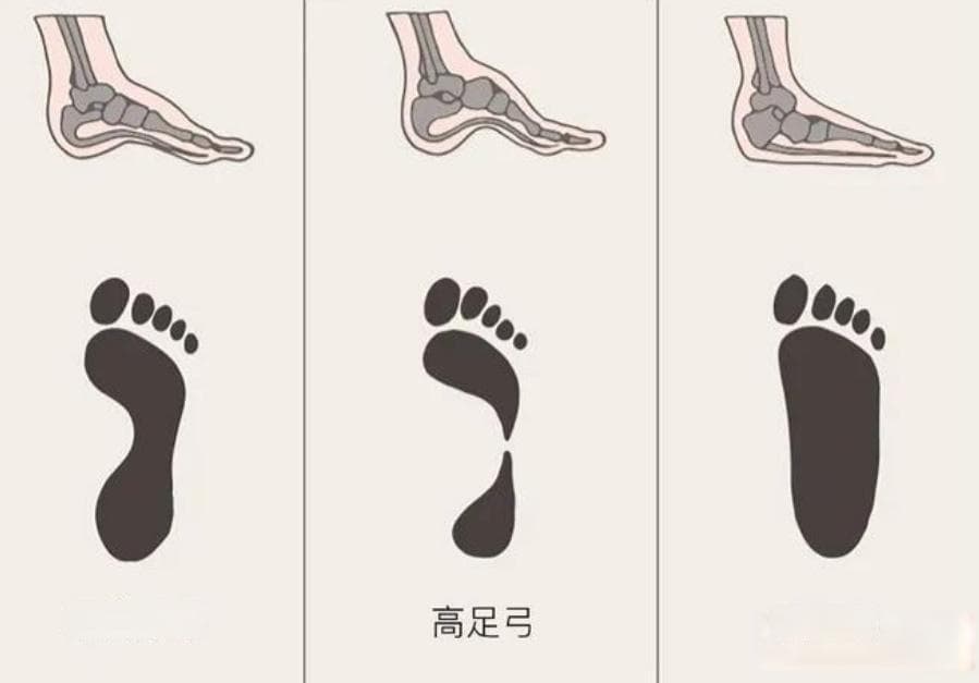 跑步鞋选购避坑指南：从脚型到场景的三大黄金法则
