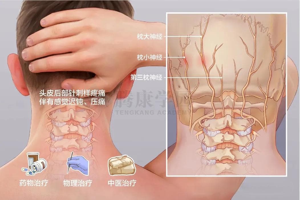 一咳嗽就头痛，警惕这根神经出了错