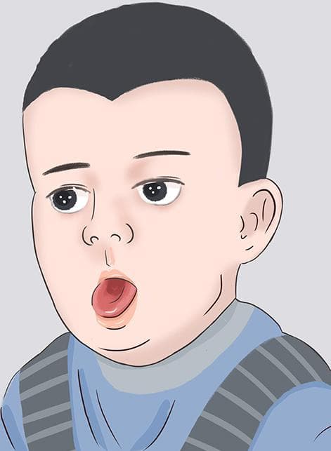 儿童咳嗽出一坨一坨的黄痰