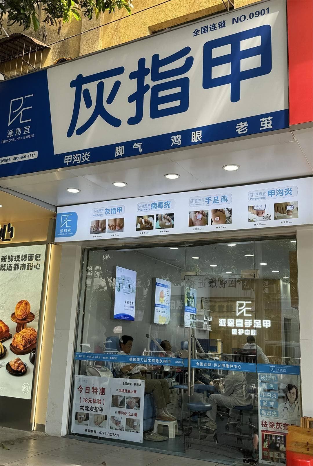 美甲、修脚店也能治灰指甲？医生：小心“踩坑”