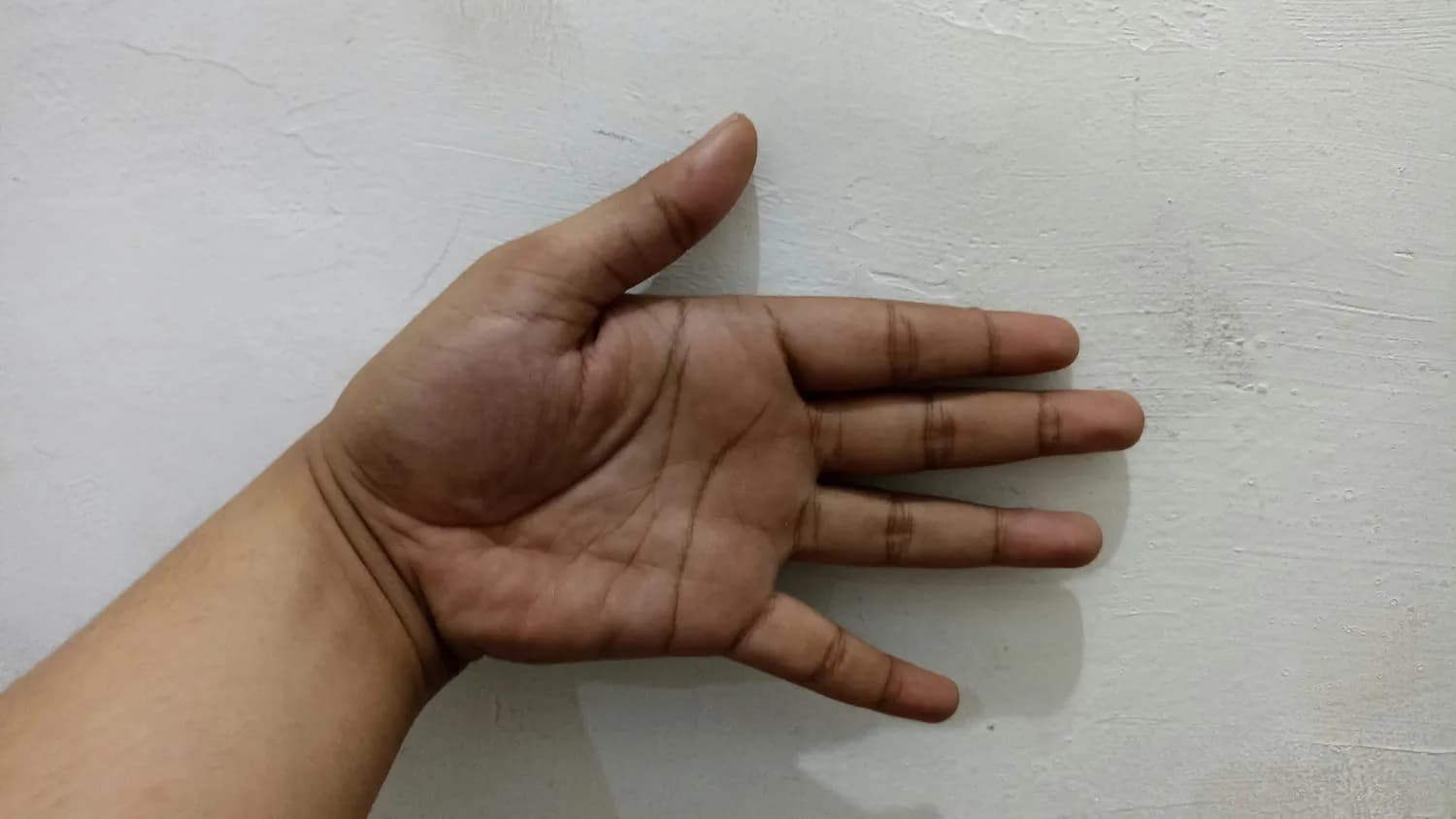 水星线揭秘：早期疾病预警的秘密