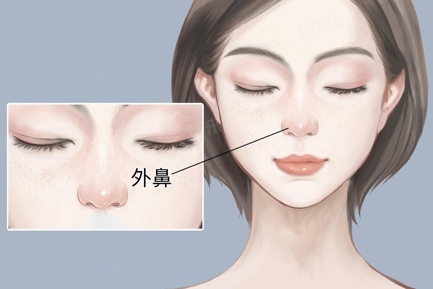 鼻梁上有黑色素沉淀怎么办