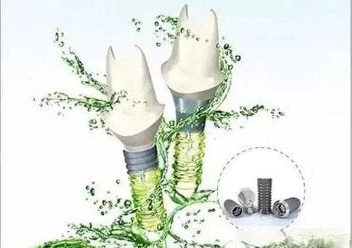 ITI愈合基台型号图谱：RC、NC及其他特色基台详解与选择指南