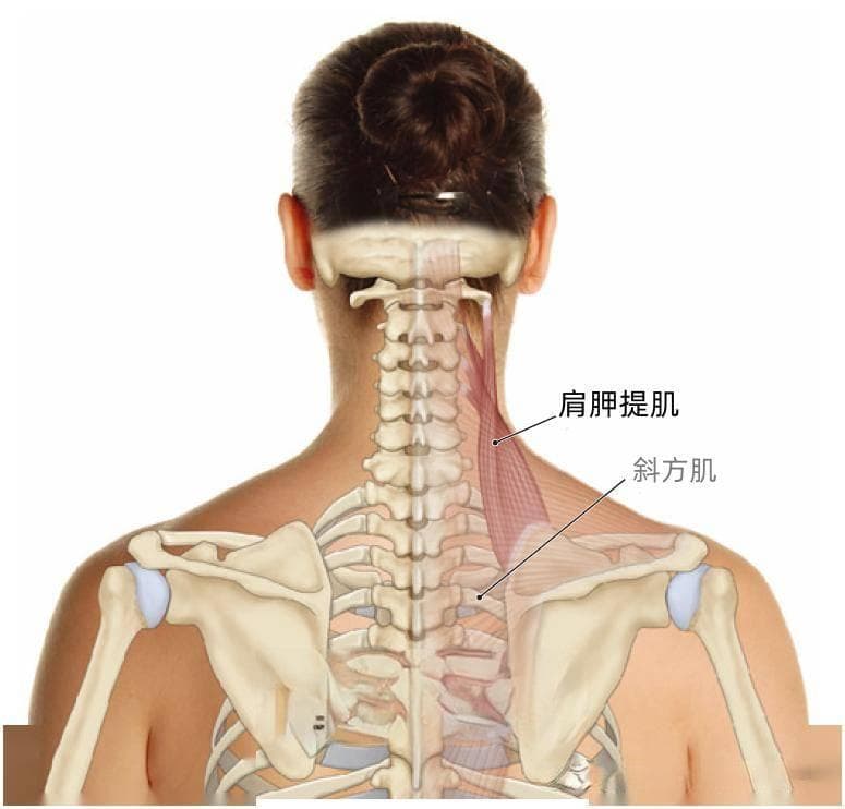 肩胛骨上角顽固性疼痛，最可能与这块肌肉有关
