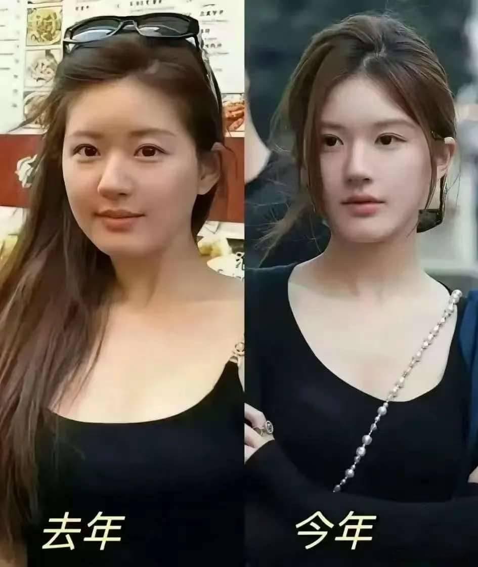 从剥栗子到重新走路：赵露思的康复之路