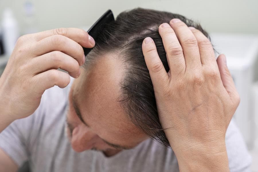 中老年人如何做，头发才不会继续掉？