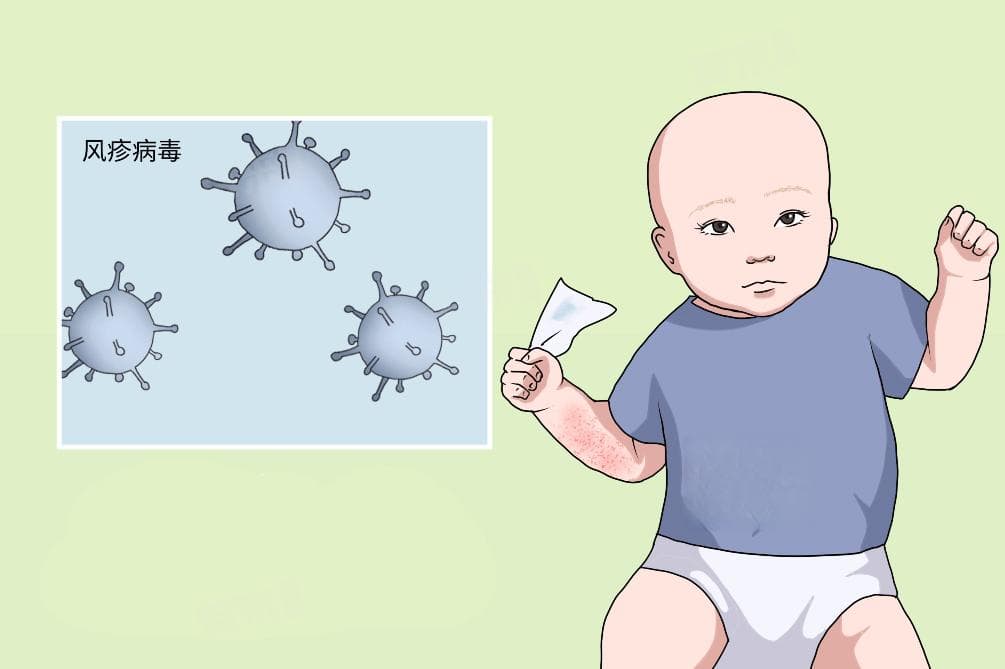 风疹病毒是什么病