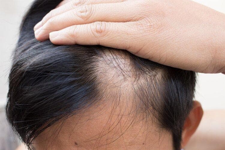 为了10万根头发的健康，「头皮」到底有多难？