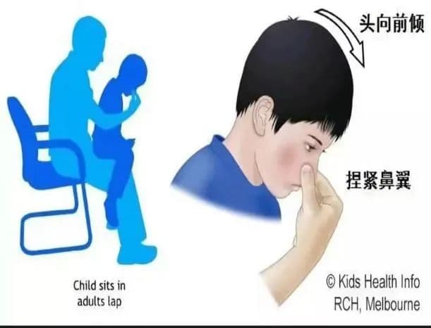 遇到鼻出血不要慌