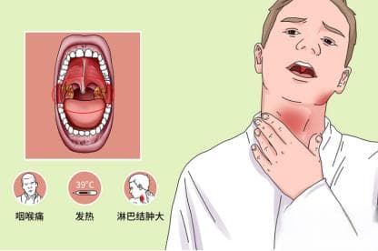 扁桃体发炎的症状揭秘：为什么会嗓子疼、咽喉红肿？