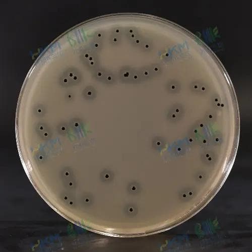 微生物在不同培养基上的菌落形态特征及比较