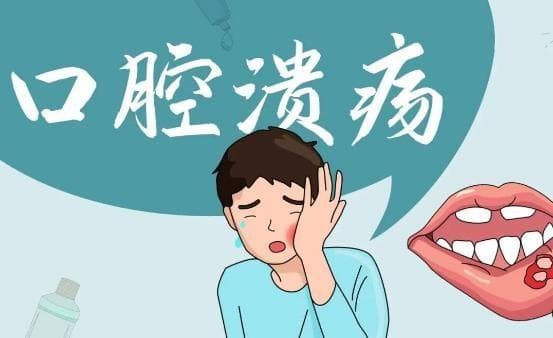小小口腔溃疡，可不是上火那么简单，严重的可能致命！