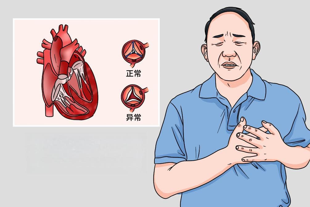心脏瓣膜手术费用详解：影响因素与参考价格