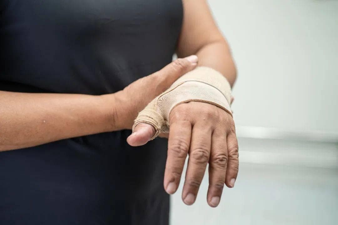 手部腱鞘炎是什么病？医生教你如何治疗与护理