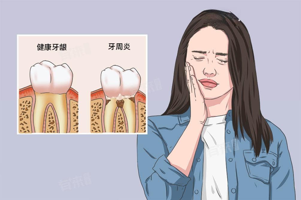 牙周治疗的费用大概是多少