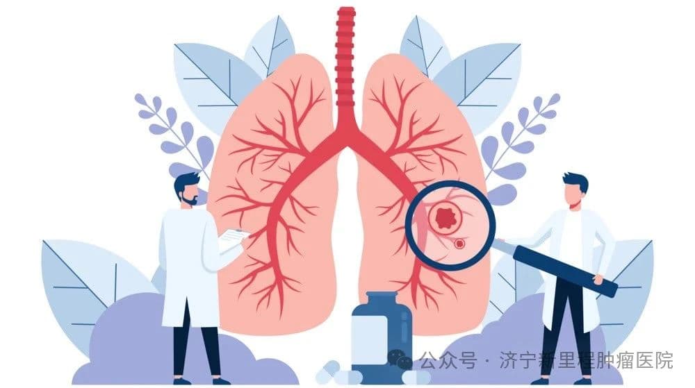 体检发现肺结节怎么办？这份专业指南请收好