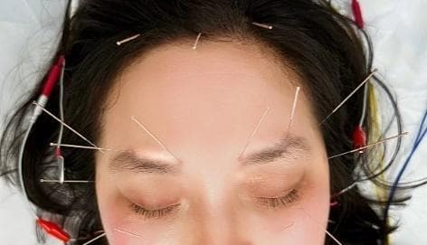 不停眨眼非秋波，可能是种病