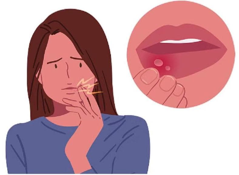 年底加班狂魔来袭，你的舌头还好吗？