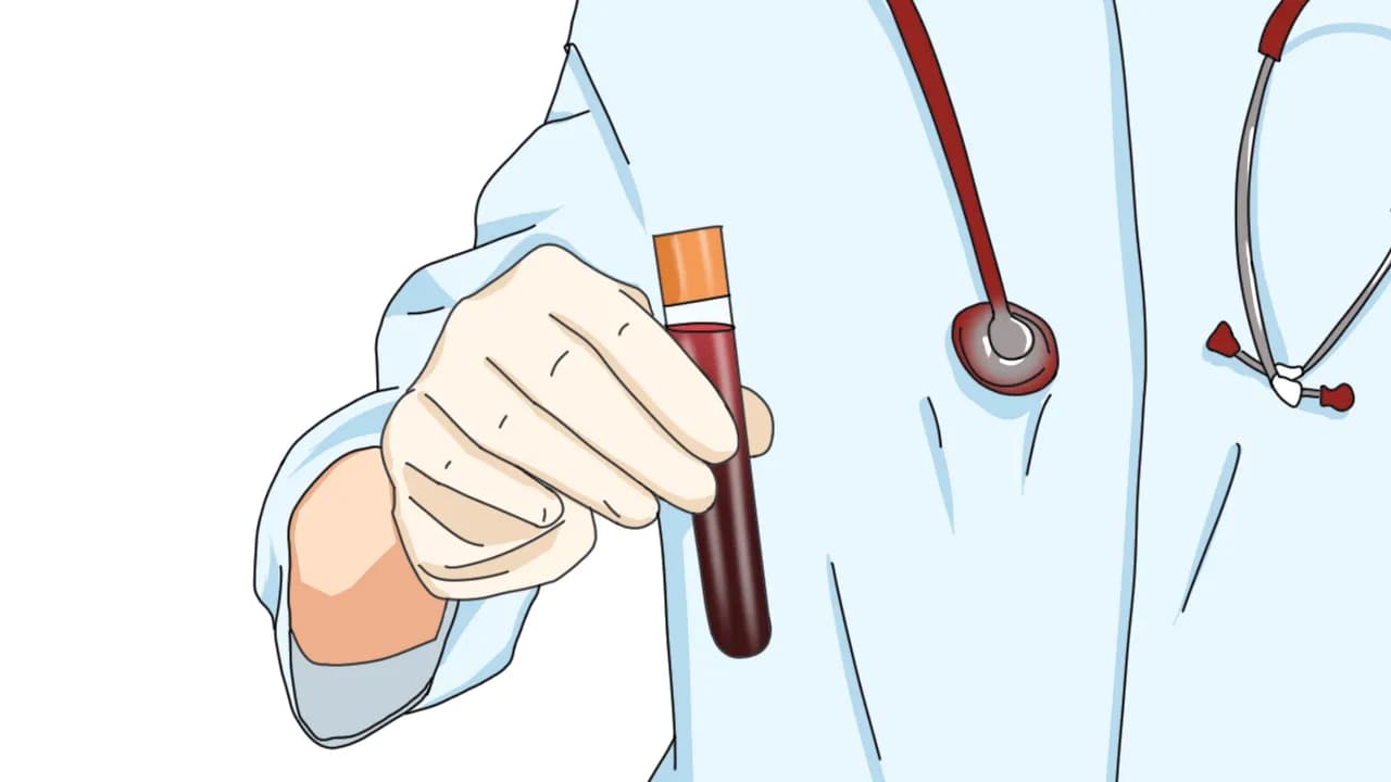 红细胞分布宽度偏低的原因及应对方法