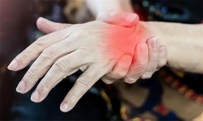 什么是腱鞘炎？得了腱鞘炎别怕，医生告诉你解决方法