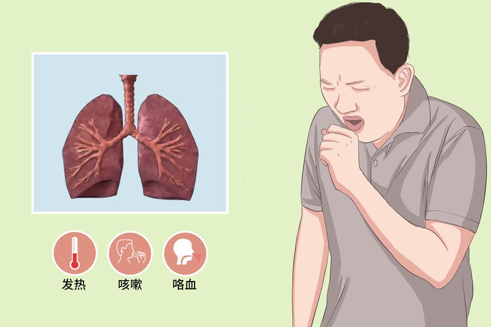 类脂性肺炎：病因、症状、诊断与治疗全解析