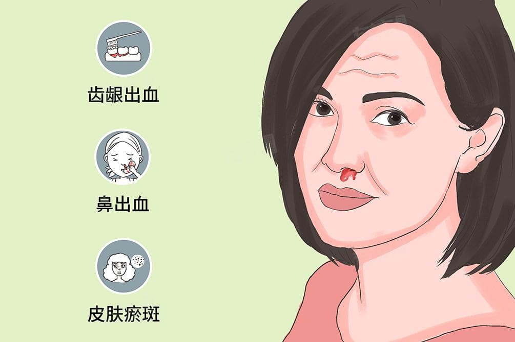 纤维蛋白原偏低