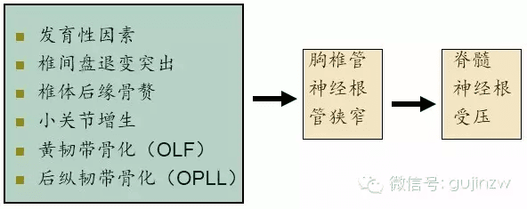 专题教程：如何准确诊断胸椎管狭窄？（附4例误诊病例分析）