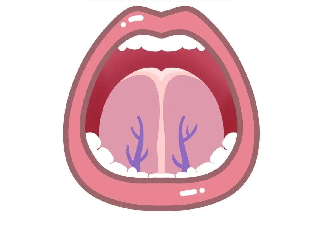 肝气郁结由轻到重的4种舌象，中医教你两招，打通瘀滞、全身轻松！