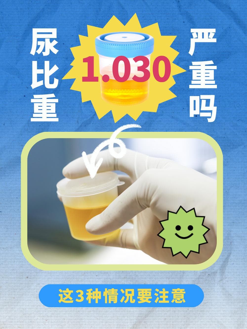尿比重1.030严重吗？这3种情况要注意
