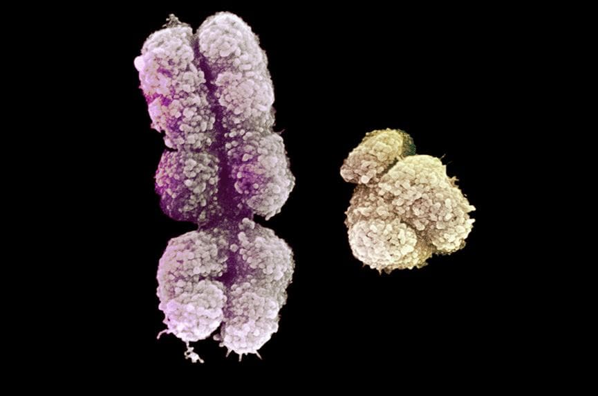 Nature重大突破：科学家成功完成Y染色体测序，标志着人类基因组的完整解读