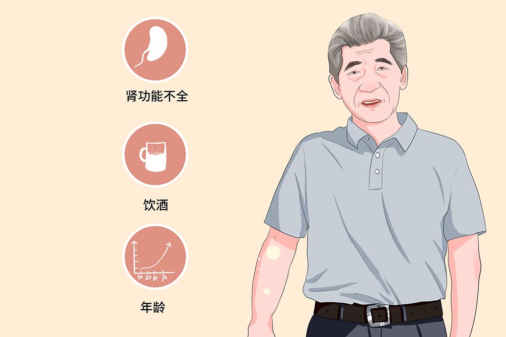 胳膊疼属于痛风吗